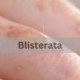 Blisterata