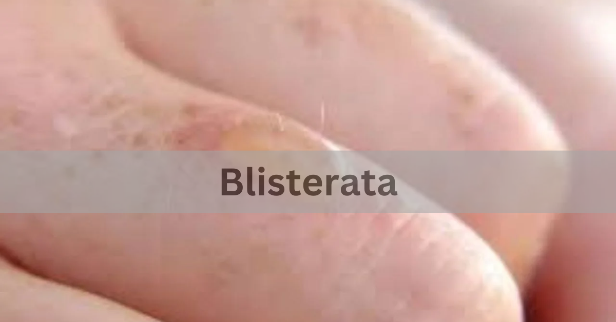 Blisterata